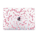 Twisted Pink Macbook Case